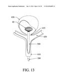 EXCLUSION DEVICE AND SYSTEM FOR DELIVERY diagram and image