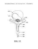 EXCLUSION DEVICE AND SYSTEM FOR DELIVERY diagram and image