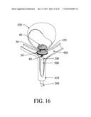 EXCLUSION DEVICE AND SYSTEM FOR DELIVERY diagram and image