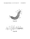 Methods And Devices For Embolic Protection diagram and image