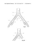 INTRODUCER FOR AN ILIAC SIDE BRANCH DEVICE diagram and image