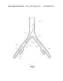 INTRODUCER FOR AN ILIAC SIDE BRANCH DEVICE diagram and image