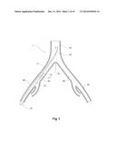 INTRODUCER FOR AN ILIAC SIDE BRANCH DEVICE diagram and image