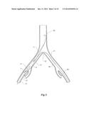 INTRODUCER FOR AN ILIAC SIDE BRANCH DEVICE diagram and image