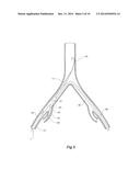 INTRODUCER FOR AN ILIAC SIDE BRANCH DEVICE diagram and image