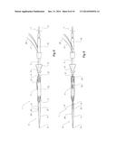 INTRODUCER FOR AN ILIAC SIDE BRANCH DEVICE diagram and image