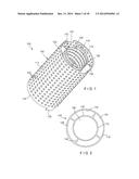 Graft Collection and Containment System for Bone Defects diagram and image