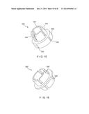 Graft Collection and Containment System for Bone Defects diagram and image