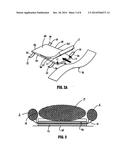 Patient Positioning System diagram and image