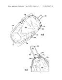 FIELD STRETCHER diagram and image