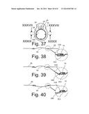 Beverage Can Having Deflecting Closure Element diagram and image