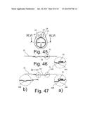 Beverage Can Having Deflecting Closure Element diagram and image