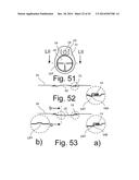 Beverage Can Having Deflecting Closure Element diagram and image