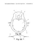 Beverage Can Having Deflecting Closure Element diagram and image