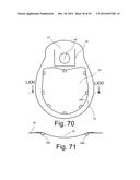 Beverage Can Having Deflecting Closure Element diagram and image