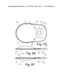 Beverage Can Having Deflecting Closure Element diagram and image