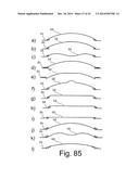 Beverage Can Having Deflecting Closure Element diagram and image