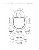 Beverage Can Having Deflecting Closure Element diagram and image