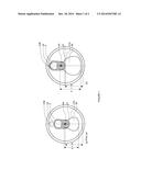 Can Comprising a Maxi-Dispense Opening and a Vent Opening diagram and image