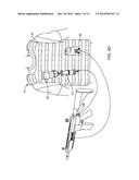 SYSTEMS AND METHODS FOR CARRYING A WEAPON diagram and image