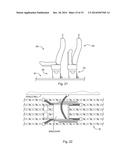 TRACK AND SEAT ADAPTER FOR POSITIONING AND LOCKING WHEELCHAIRS AND TRANSIT     SEATS diagram and image