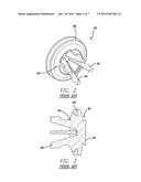 VALVE MEMBER WITH COMPOSITE SEAL diagram and image