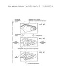 METHODS OF USING ADIPOSE TISSUE-DERIVED CELLS IN THE TREATMENT OF THE     LYMPHATIC SYSTEM AND MALIGNANT DISEASE diagram and image