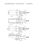 DENTAL IMPLANT SYSTEM diagram and image