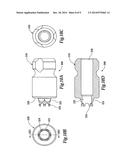 DENTAL IMPLANT SYSTEM diagram and image