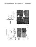 Proteasome Deubiquinating Inhibitor Screening diagram and image