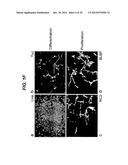 Neural Stem Cells diagram and image