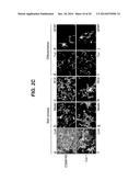 Neural Stem Cells diagram and image