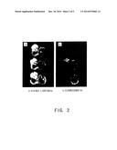 TROPHECTODERMAL CELL-SPECIFIC GENE TRANSFER METHODS diagram and image