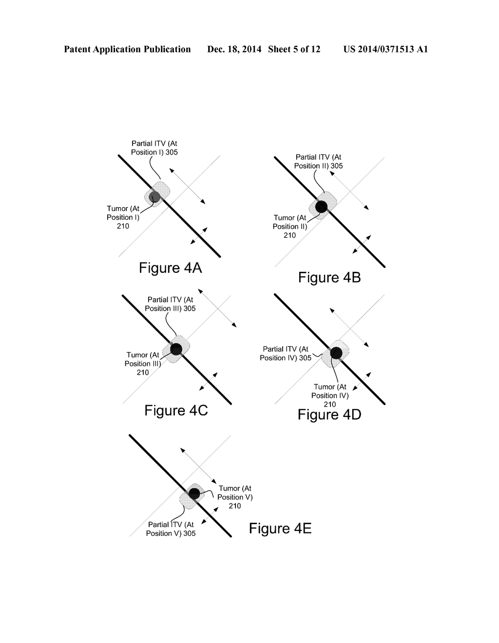 TREATING A TARGET'S PARTIAL MOTION RANGE - diagram, schematic, and image 06