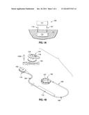 Inductively Powered Remotely Adjustable Gastric Banding System diagram and image