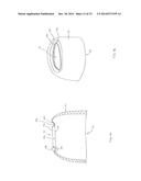 FORNIX MANIPULATOR diagram and image