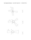 FORNIX MANIPULATOR diagram and image