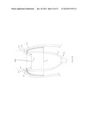 FORNIX MANIPULATOR diagram and image