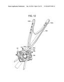 Retractor diagram and image