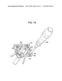 Retractor diagram and image