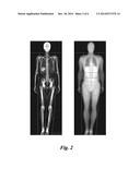 METHOD FOR MEASURING LIVER FAT MASS USING DUAL-ENERGY X-RAY ABSORPTIOMETRY diagram and image