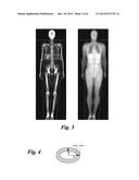 METHOD FOR MEASURING LIVER FAT MASS USING DUAL-ENERGY X-RAY ABSORPTIOMETRY diagram and image