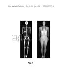 METHOD FOR MEASURING LIVER FAT MASS USING DUAL-ENERGY X-RAY ABSORPTIOMETRY diagram and image