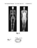 METHOD FOR MEASURING LIVER FAT MASS USING DUAL-ENERGY X-RAY ABSORPTIOMETRY diagram and image