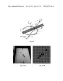 PATIENT MOUNTED MRI AND CT COMPATIBLE ROBOT FOR NEEDLE GUIDANCE IN     INTERVENTIONAL PROCEDURES diagram and image