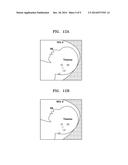 METHOD FOR AUTOMATICALLY DETECTING MID-SAGITTAL PLANE BY USING ULTRASOUND     IMAGE AND APPARATUS THEREOF diagram and image