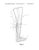 Adjustable-Slider, Equinus Brace With Toe Wedge diagram and image