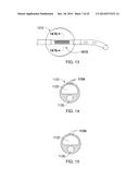 Stretch Valve Balloon Catheter and Methods for Producing and Using Same diagram and image