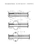 Stretch Valve Balloon Catheter and Methods for Producing and Using Same diagram and image