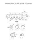 Minimally Invasive Lung Volume Reduction Devices, Methods, and Systems diagram and image